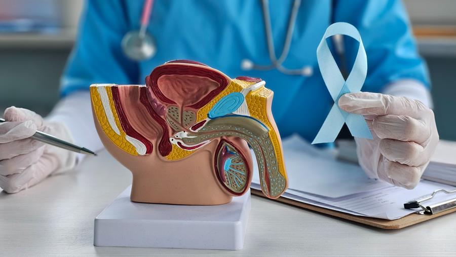 Cancer de la prostate : PROTEUS valide l’intensification périopératoire