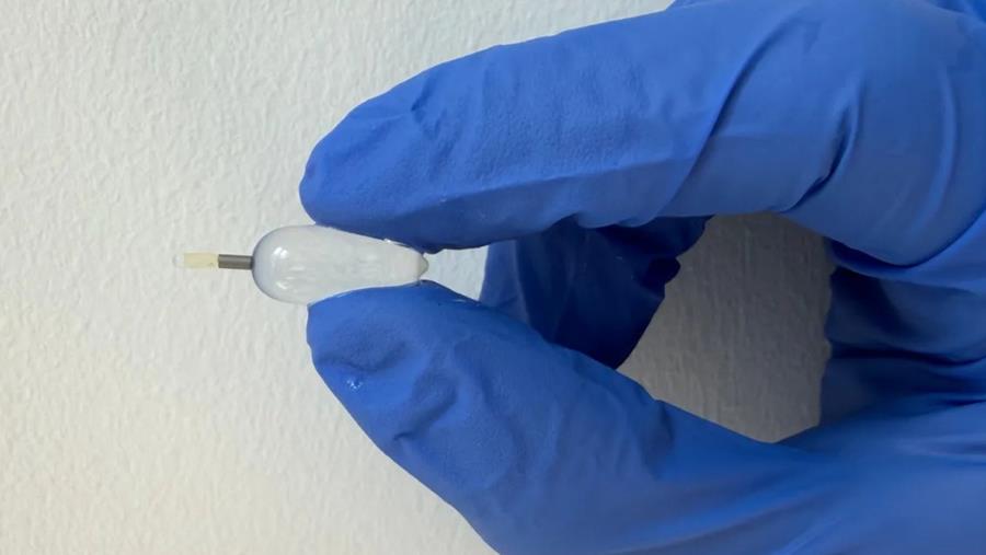 Slimme ballon voor behandeling congenitale diafragmatische hernia